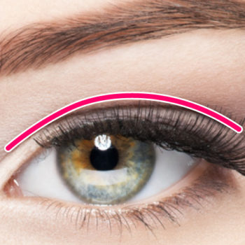 二重 整形 全切開 大阪