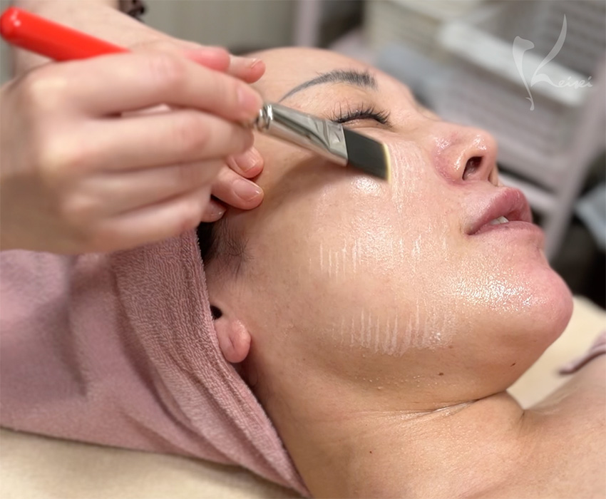 ララピール第1薬を塗布