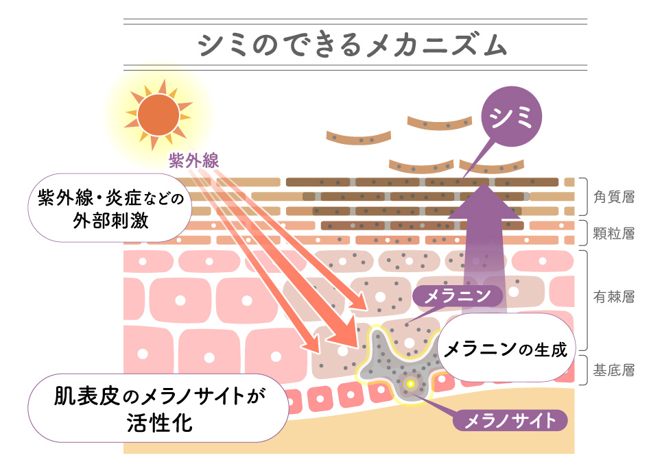 シミのできるメカニズム図