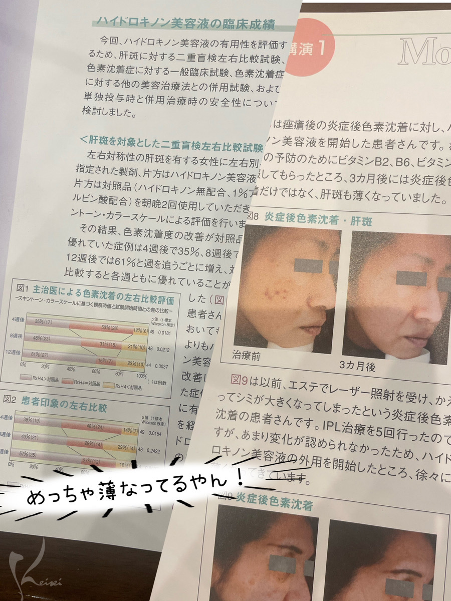 シミの新しい治療　学会パンフレット2