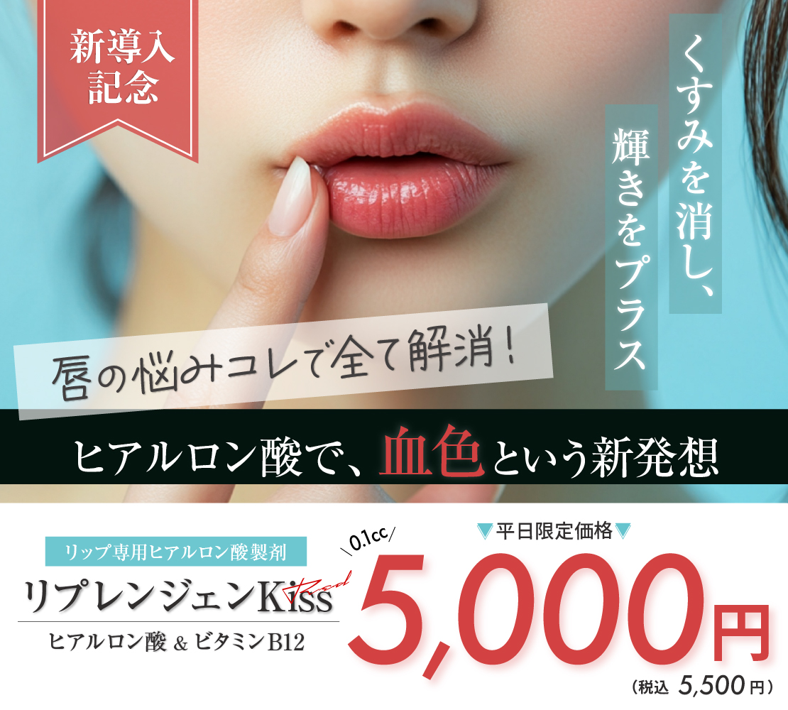 リプレンジェンKissバナー