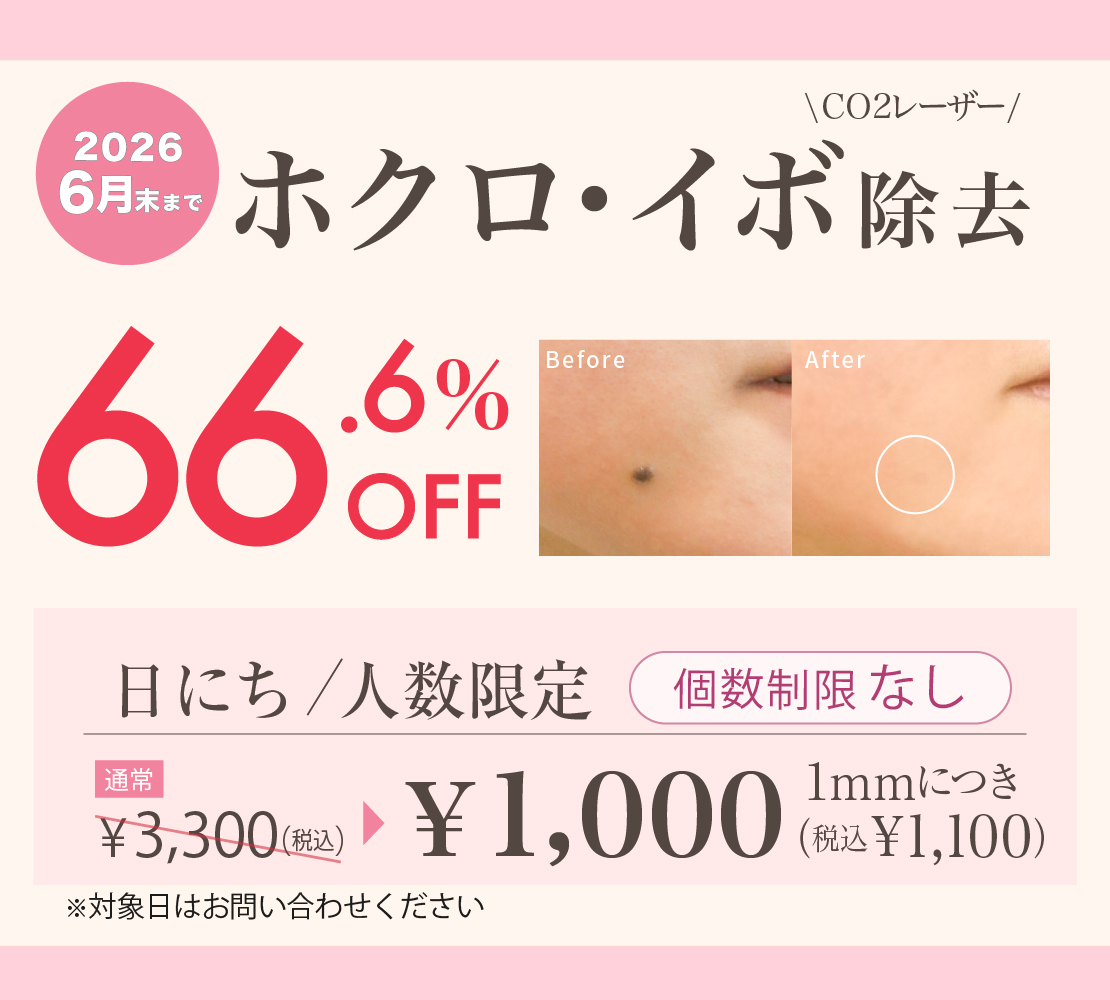 ホクロ・イボ除去キャンペーンバナー