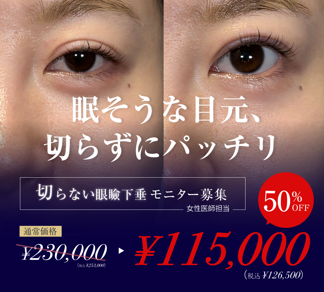 「切らない眼瞼下垂」モニター募集バナー