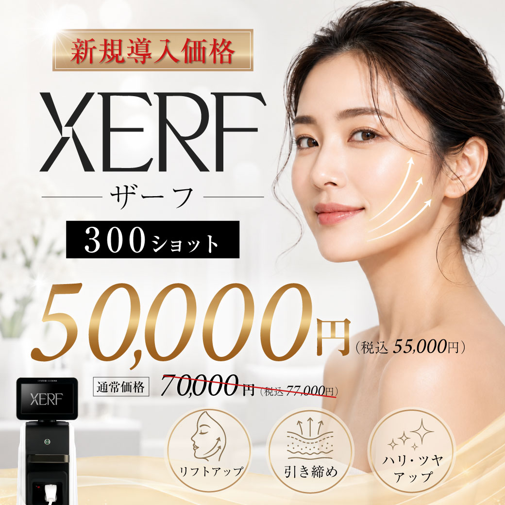 XERF（ザーフ）キャンペーンバナー