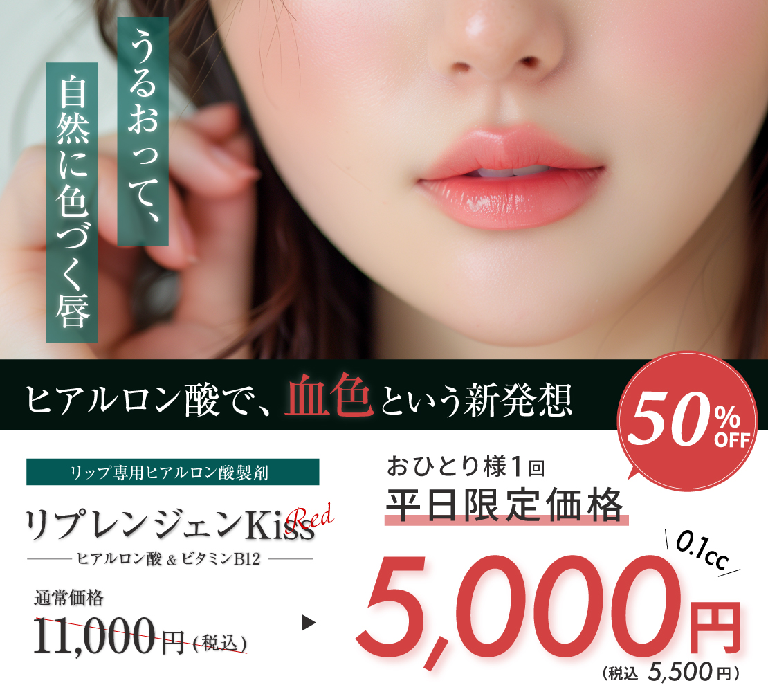 リプレンジェンKiss Red割引キャンペーン