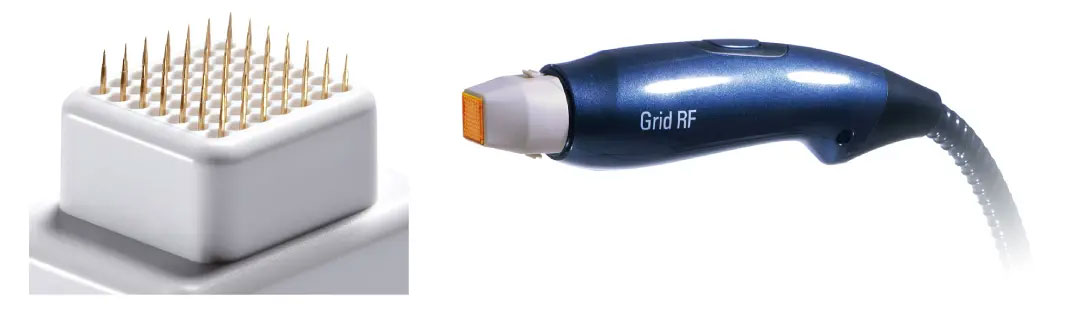 イントラセル frm ウルトラセル ニキビ ニキビ跡 エイジングケア アンチエイジング