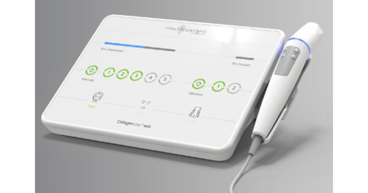 コラジェナイザー