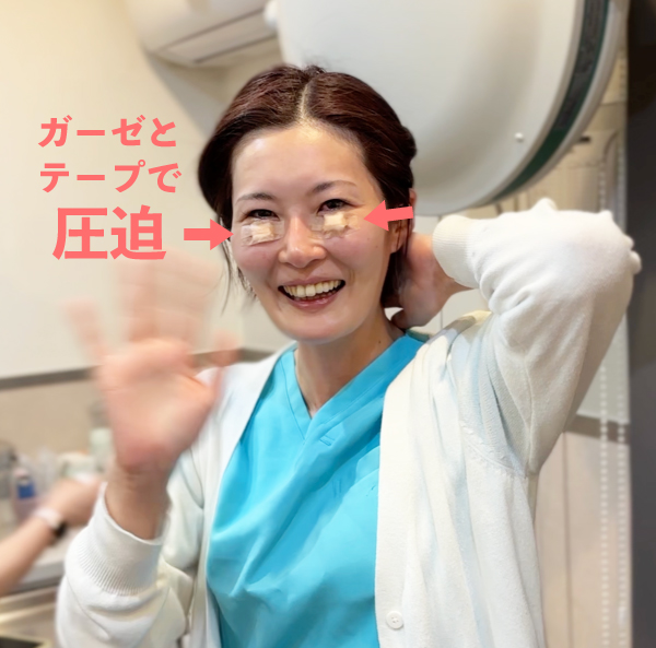 ガーゼ＋テープで圧迫写真