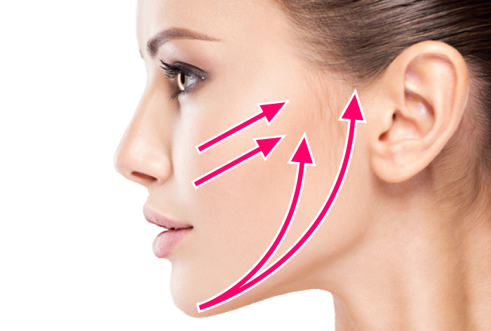 アルテミスリフト