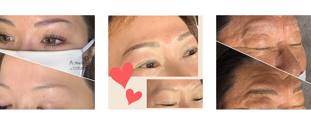 アートメイク症例写真