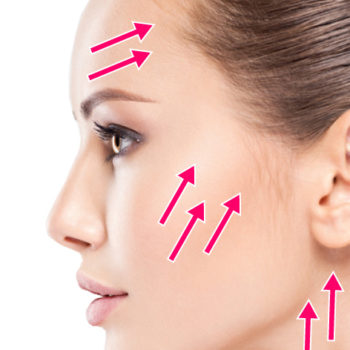 vリフト ショッピングリフト リフトアップ 美容鍼 エイジングケア アンチエイジング 糸リフト