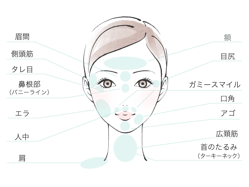 ボトックス 注入箇所 眉間 アゴ エラ ワキ 肩 目尻 ガミースマイル 鼻根部 首 人中