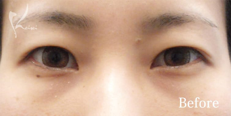 Before写真