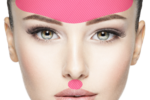 トータルセントラルリフトアップ