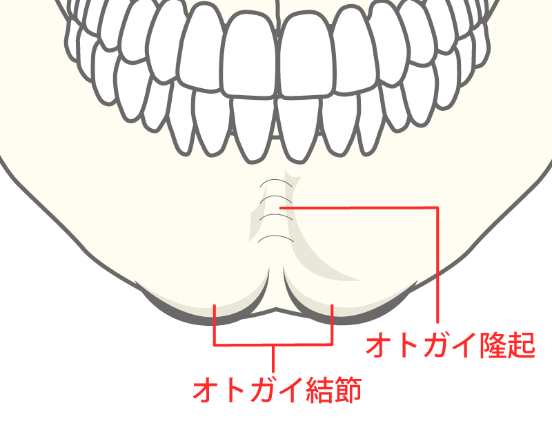 オトガイ結節・オトガイ隆起イメージ