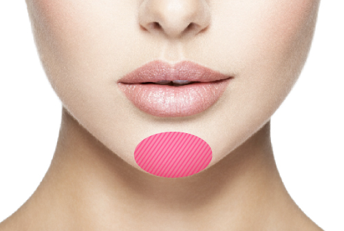 割れアゴ（ケツアゴ）修正サムネイル