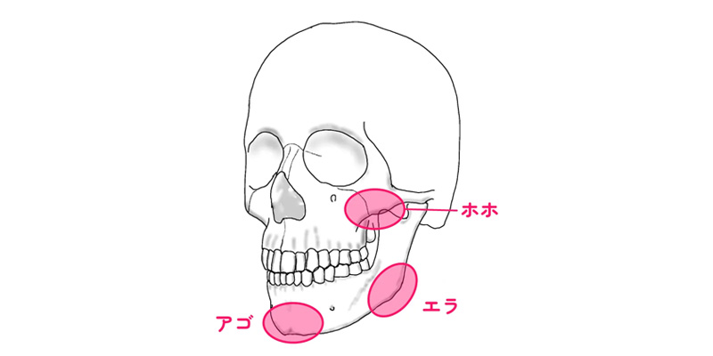 エラと頬骨とオトガイを整える輪郭3点の対象部位