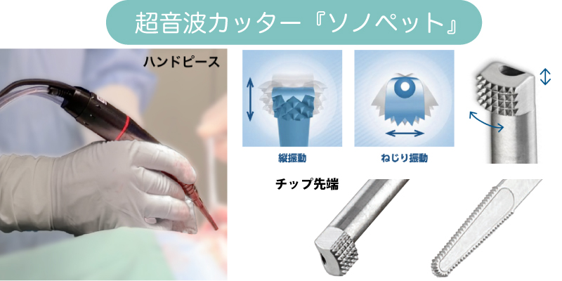ソノペット