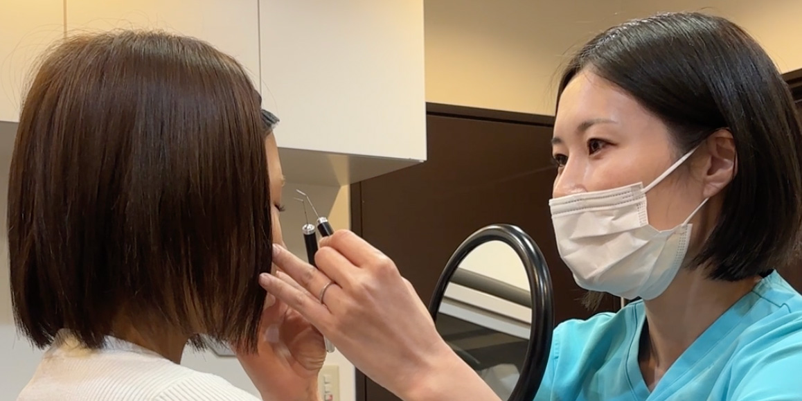 二重整形後のダウンタイムと注意点を説明するイメージ