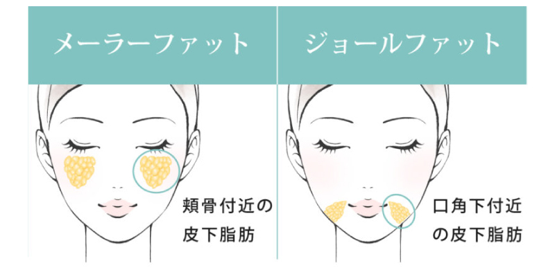 顔の脂肪