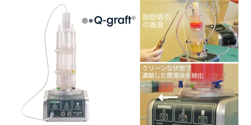 Q-graft（キューグラフト）システムを説明するイメージ