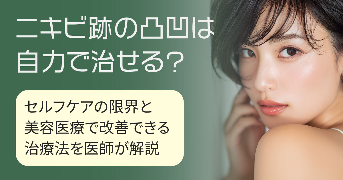 ニキビ跡の凹凸と美容医療での改善方法を解説するイメージ
