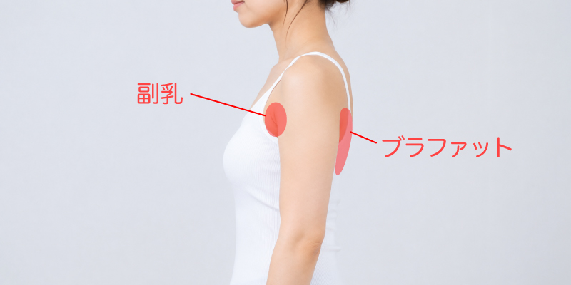 副乳、ブラファットの場所