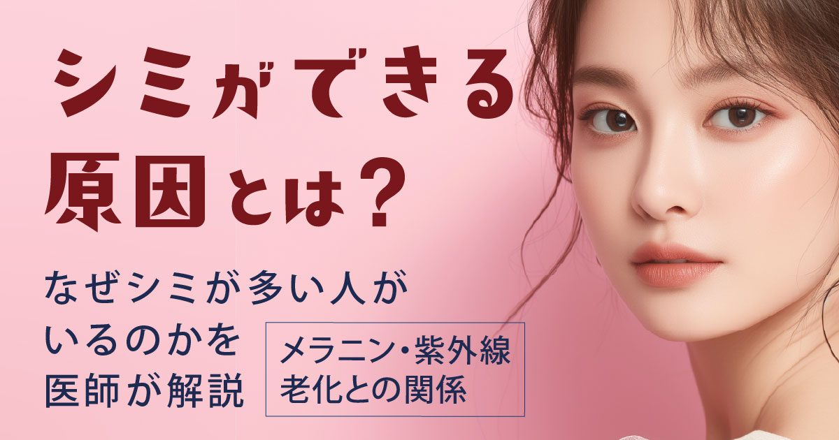 シミができる原因を医師が解説するイメージ