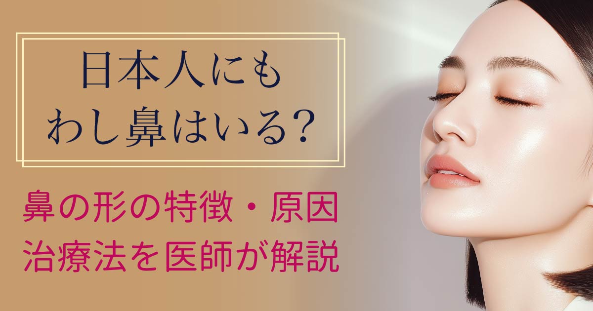 日本人のわし鼻の特徴と治療法を解説するイメージ