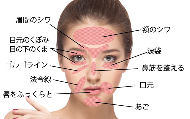 ヒアルロン酸の注入量と製剤を確認する医師