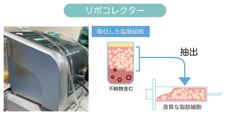 リポコレクター