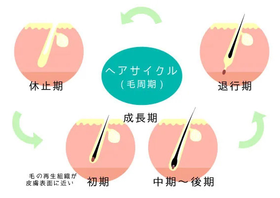 毛周期と医療レーザー脱毛の効果を説明するイメージ