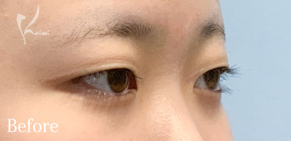 Before写真
