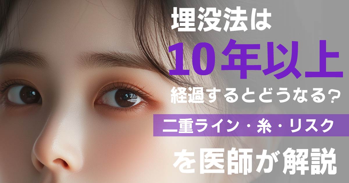 埋没法が10年以上経過したときの二重ラインと糸のリスクを解説