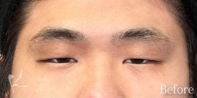 Before写真