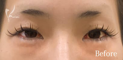 Before写真
