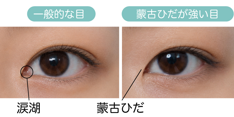 蒙古襞の強い目イメージ