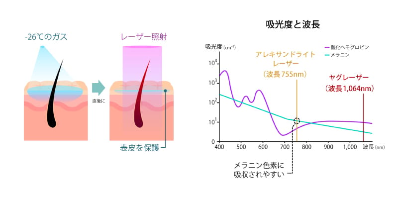 医療レーザーが毛根周囲に作用する仕組みのイメージ