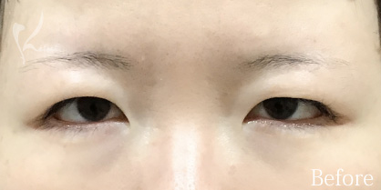 Before写真