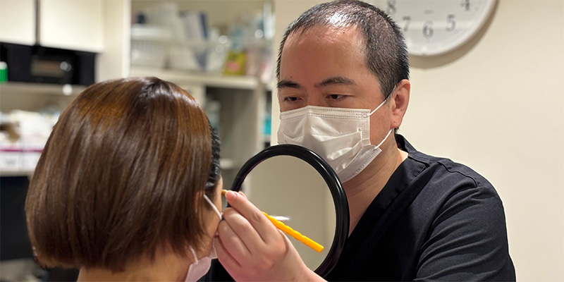 二重埋没法の手術をする医師のイメージ