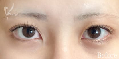 Before写真