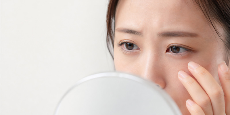 経結膜脱脂が向いている人のイメージ