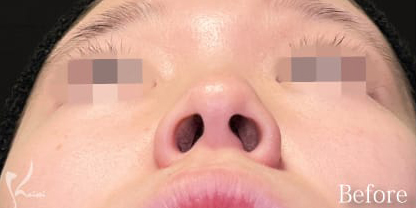 Before写真