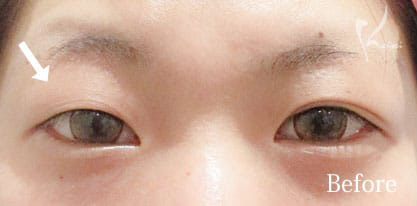 Before写真