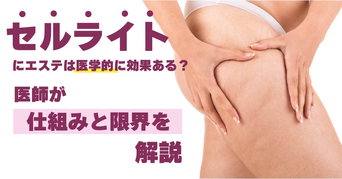セルライトに対するエステの効果と医学的な限界を解説