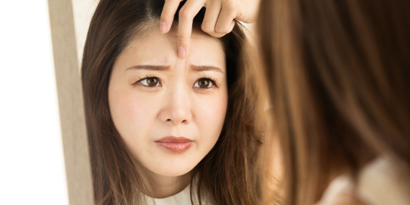 眉間にできる動的なしわと静的なしわのイメージ