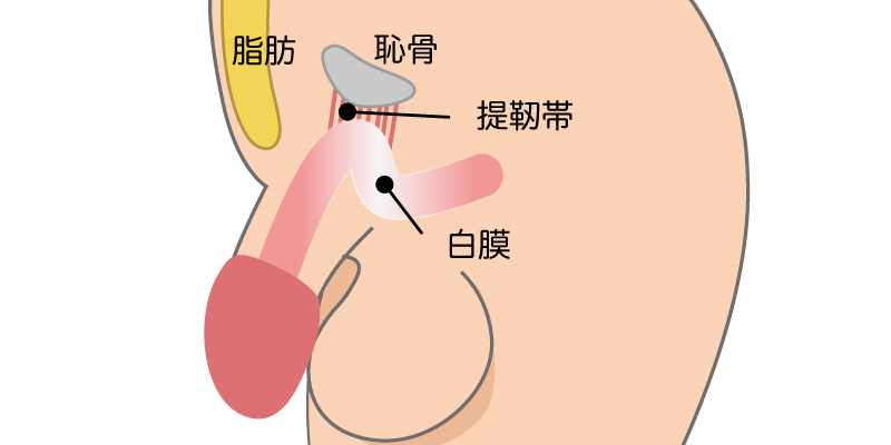 陰茎が埋もれて短く見える原因を示すイメージ