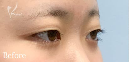 Before写真