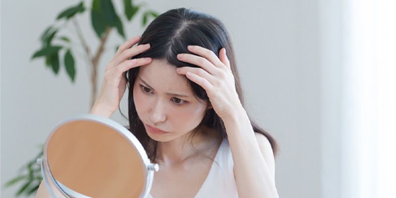 女性型脱毛症で分け目や頭頂部が薄くなるイメージ