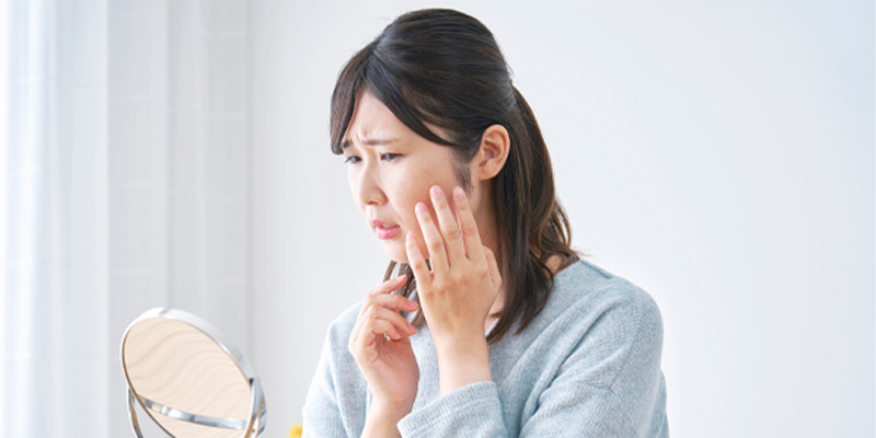 糸リフト後のダウンタイムとアフターケアのイメージ